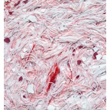 Рідкі шпалери 983 Bioplast Рідкі шпалери 983 Bioplast